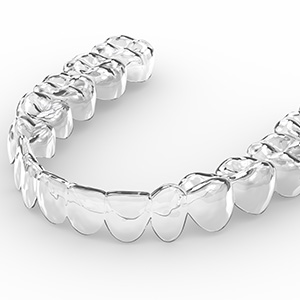 Closeup of a clear aligner on a white background